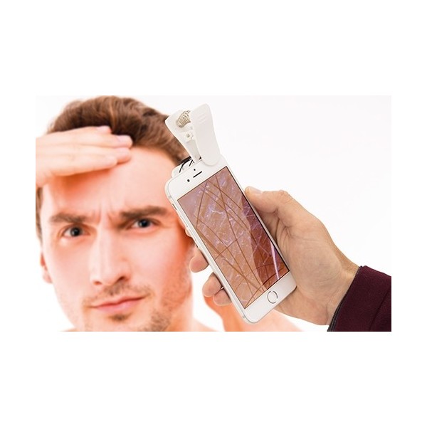 Microscopio Móvil PLANET